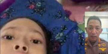 Kapolri Hubungi Bocah Penderita Tumor Tulang, Segera Kirim Tim Dokter