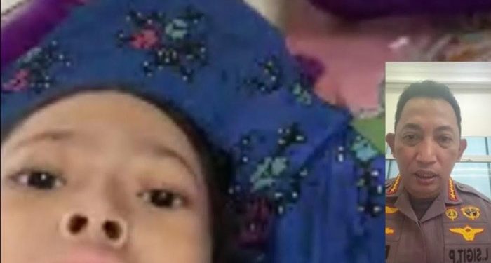 Kapolri Hubungi Bocah Penderita Tumor Tulang, Segera Kirim Tim Dokter